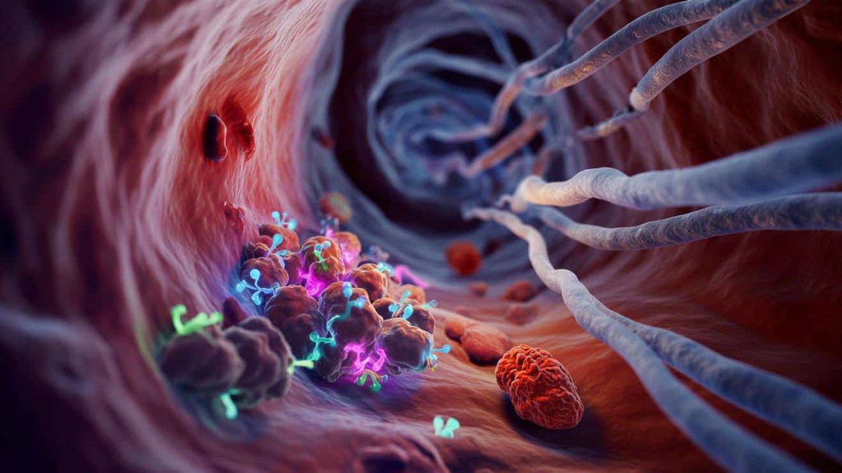 The Invisible Cancer Cells That Experts Can Now See (You Won’t Believe How)
