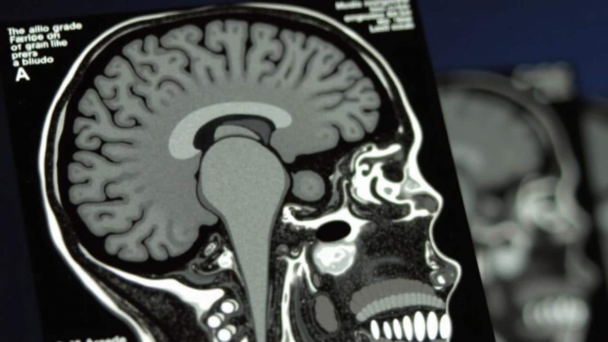 Shocking Reason Why Teenagers Refuse to Listen to Their Parents (MRI Scans Reveal All)