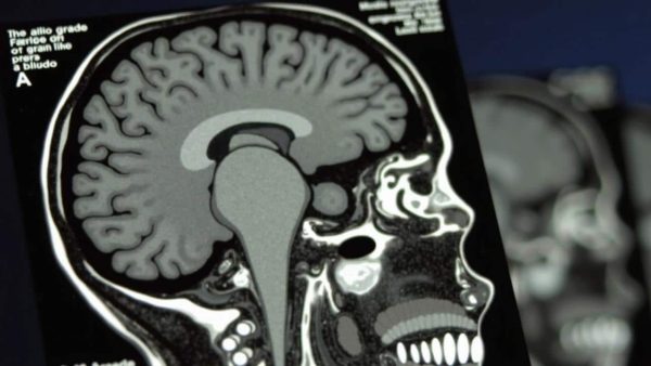 Shocking Reason Why Teenagers Refuse to Listen to Their Parents (MRI Scans Reveal All)