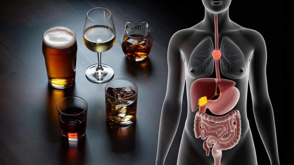 The Shocking Truth About Alcohol and Cancer: What You Need to Know Now