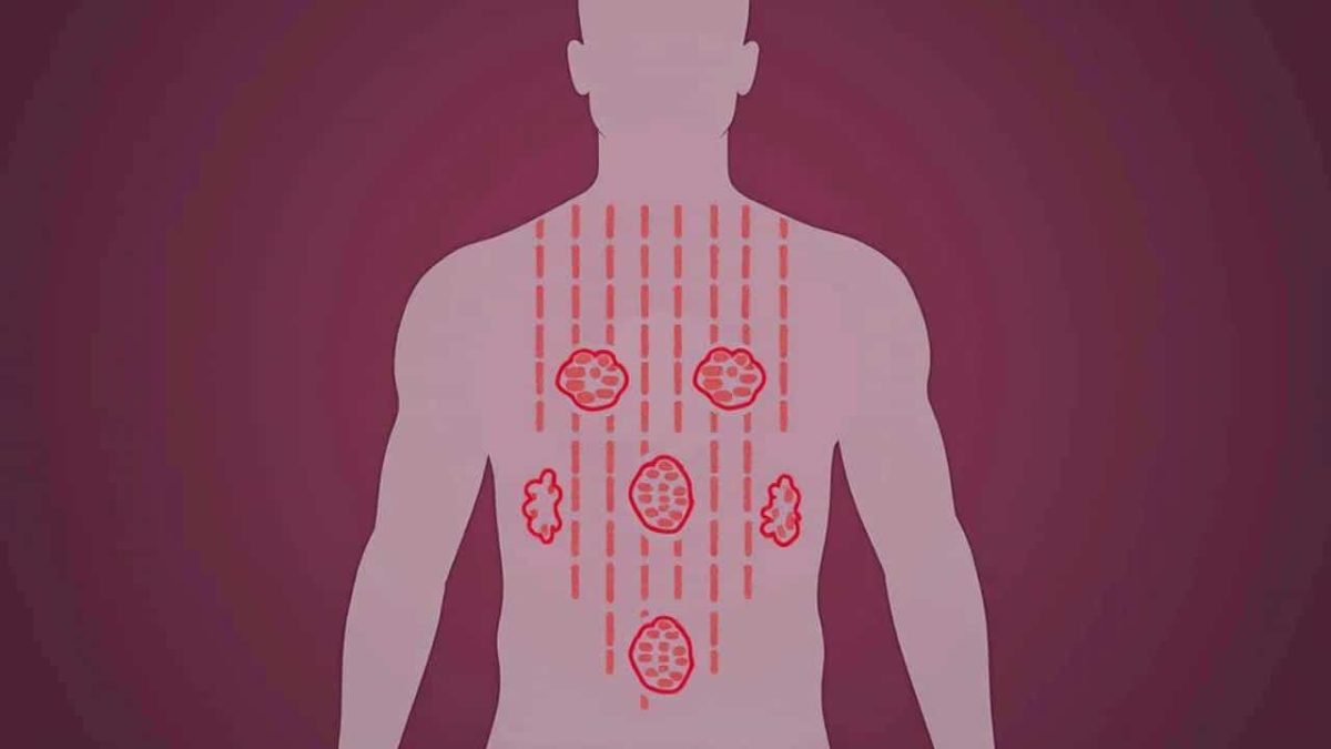 Hereditary diseases: science finds the risk was vastly overestimated