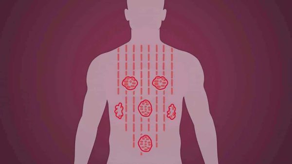 Hereditary diseases: science finds the risk was vastly overestimated