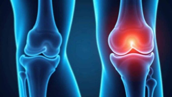 This pillar of osteoarthritis treatment shows more modest results than expected