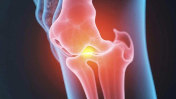 The Shocking Rheumatoid Arthritis Epidemic That’s Hiding in Plain Sight
